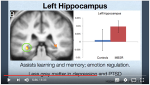 Hippocampe gauche et méditation pleine conscience